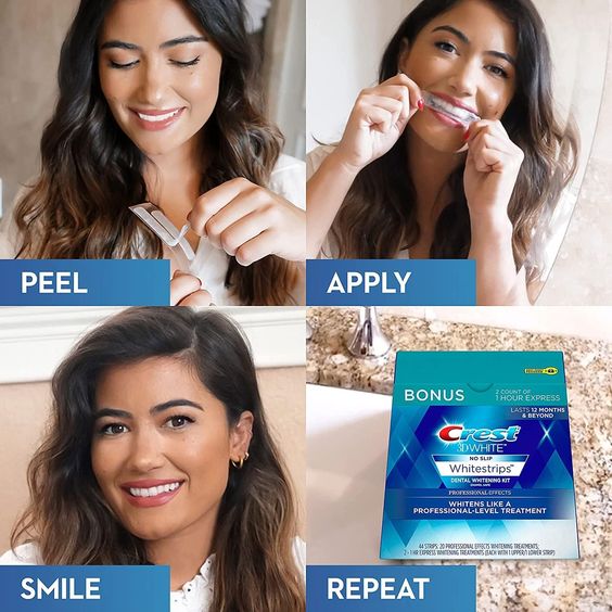 Top 10 Teeth Whitening Kits for 2024 — photo 2 Top 10 Teeth Whitening Kits for 2024 — photo 2