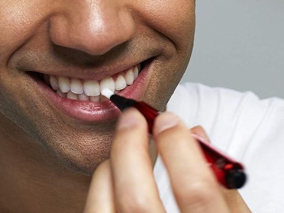 Top 10 Teeth Whitening Kits for 2024 — photo 12 Top 10 Teeth Whitening Kits for 2024 — photo 12